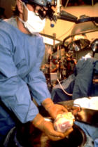 Transplantation of heart